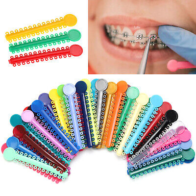 Orthodontic Ligature Ties (40 pcs.)